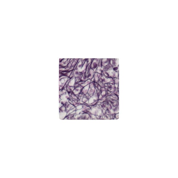 Reticulum Stain Kit
